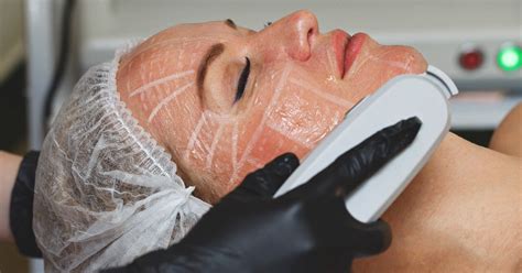HIFU for Face Treatment: Benefits, Cost, Efficacy & More.